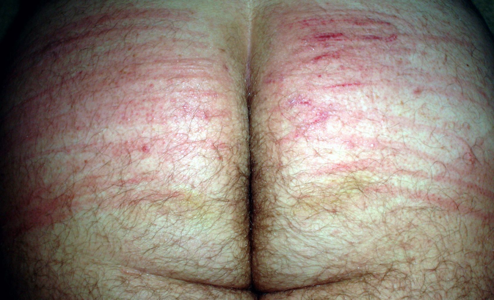 Hard spanking, for cucky, with electric cable. — 9